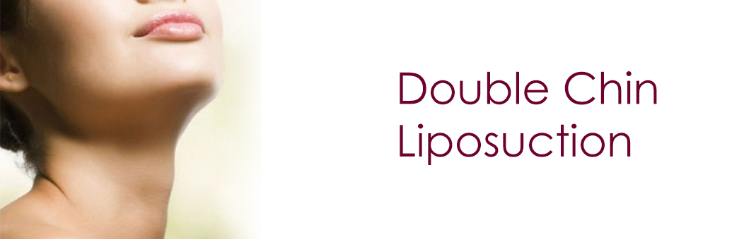 double chin neck face liposuction in Ahmedabad Gujarat India