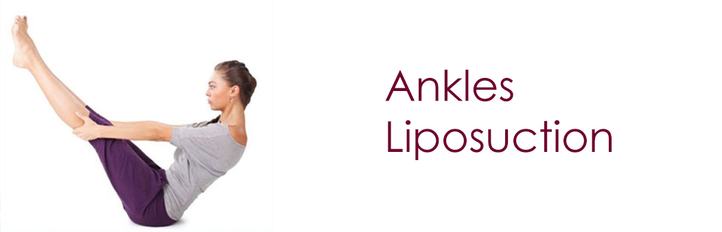 calf liposuction Ahmedabad