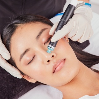 Mesotherapy Treatment